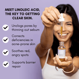 Clover by Clove + Hallow Skincare Balancing Oil Affordable Acne Skin Care | Balancing Oil