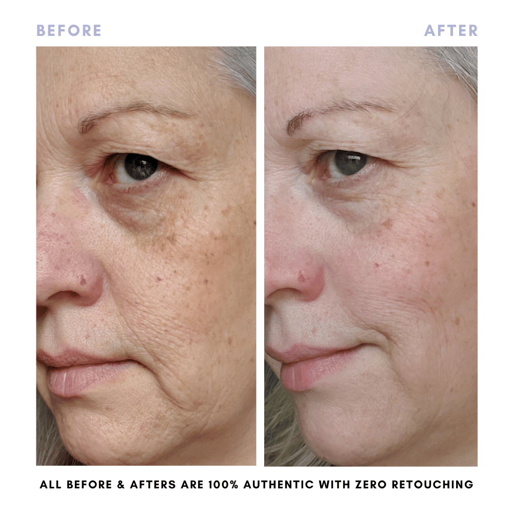 Clover by Clove + Hallow Skincare The Complete Skincare Collection The Complete Skincare Collection