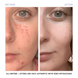 Clover by Clove + Hallow Skincare The Double Cleansing Duo