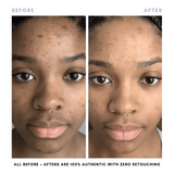 Clover by Clove + Hallow Skincare The Purifying Skincare Set