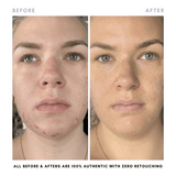Clover by Clove + Hallow The Juicy Skin Duo