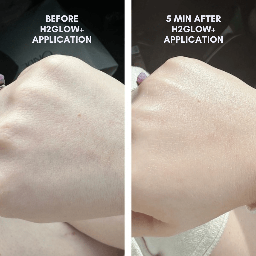 Clover by Clove + Hallow The Sensitive Skin Starter Set