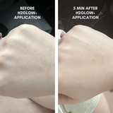 Clover by Clove + Hallow The Sensitive Skin Starter Set