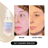 Clover by Clove + Hallow Skincare Daily Dewtox Smoothing & Brightening Essence Affordable Acne Skin Care | Balancing Oil